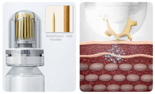 Glamory micro infusion device detail showing 24K gold-plated needle roller head close-up